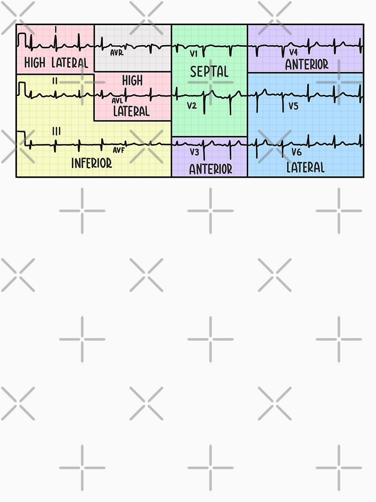 Hand Drawn 12 Lead Electrocardiogram (ECG) Pastel by SofiaSava01
